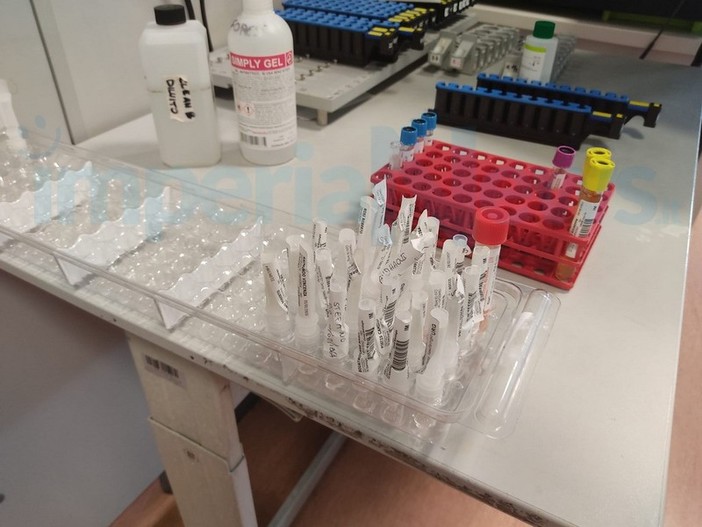 Coronavirus, in Liguria 151 i nuovi positivi nelle ultime 24 ore