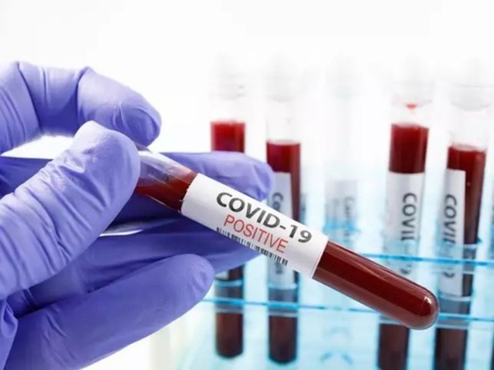 Coronavirus: numeri in lieve rialzo su base regionale: 94 nuovi positivi, ma stabili gli ospedalizzati
