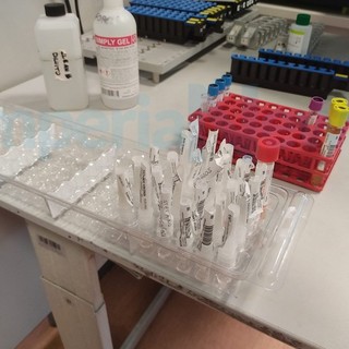 Coronavirus, in Liguria 151 i nuovi positivi nelle ultime 24 ore