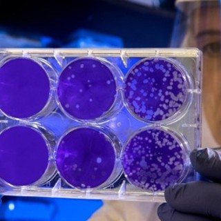 "L'incubo": il Covid 19 e le sue sofferenze dopo un anno di pandemia