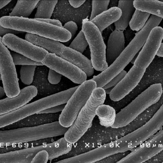 E. Coli Bacteria - Credit: NIAID