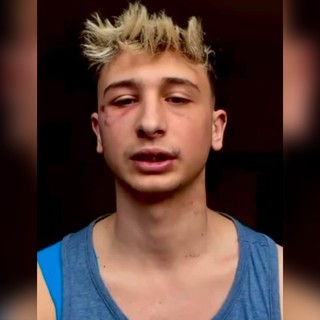 Picchiato l'influencer savonese George Ciupilan: "Purtroppo questa aggressione è uno scotto della popolarità"