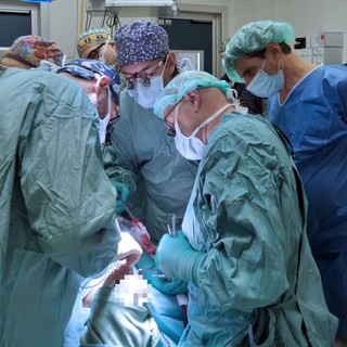 Ricostruito il volto di un bimbo di 10 mesi affetto da una rarissima malformazione facciale