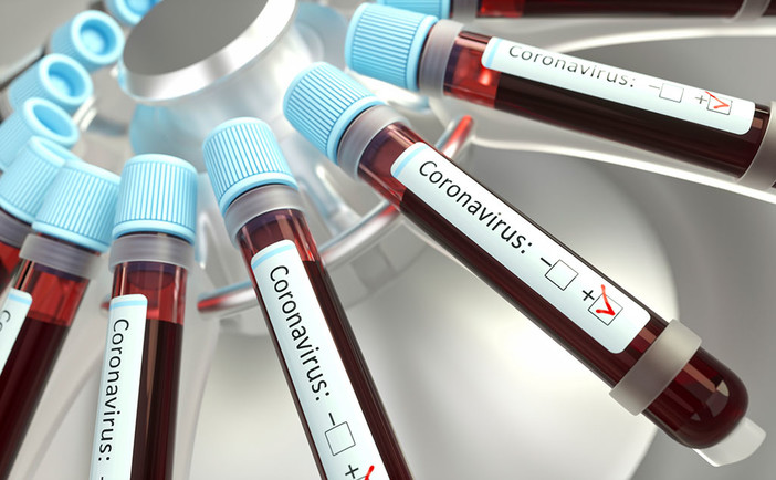 Test sierologici sui donatori di sangue, in Liguria un successo: esame accettato dalla quasi totalità dei volontari Test sierologici sui donatori di sangue, in Liguria un successo: esame accettato dalla quasi totalità dei volontari