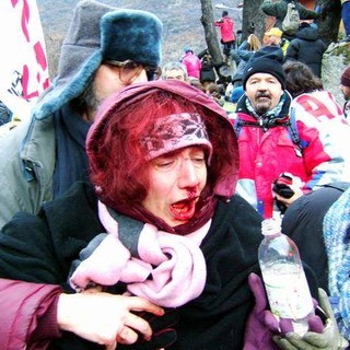 Donna ferita dalla polizia durante gli scontri in Val di Susa