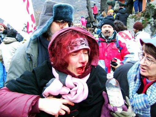 Donna ferita dalla polizia durante gli scontri in Val di Susa Donna ferita dalla polizia durante gli scontri in Val di Susa