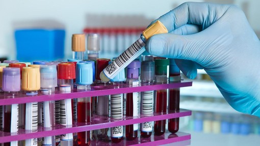 Coronavirus, a Borghetto test sierologici per i dipendenti del Comune e per i volontari della protezione civile Coronavirus, a Borghetto test sierologici per i dipendenti del Comune e per i volontari della protezione civile