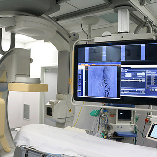 Rottura dell'angiografo al S.Corona di Pietra Ligure, De Vincenzi (Pd): &quot;Il reparto di emodinamica ne ha bisogno con urgenza&quot;