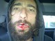 Vittorio Brumotti, trauma facciale per incidente in bici. Ecco la foto da Twitter Vittorio Brumotti, trauma facciale per incidente in bici. Ecco la foto da Twitter