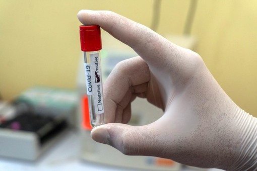 Coronavirus, in Liguria 599 nuovi positivi nelle ultime 24 ore Coronavirus, in Liguria 599 nuovi positivi nelle ultime 24 ore