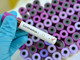 Coronavirus: 31 nuovi casi di positività in provincia, 1 paziente in terapia intensiva Coronavirus: 31 nuovi casi di positività in provincia, 1 paziente in terapia intensiva