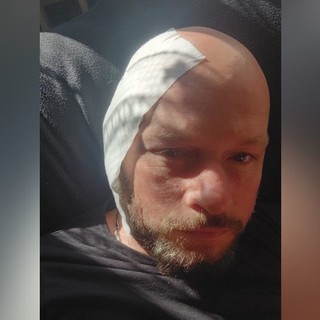 Cane azzanna un carabiniere e gli mutila un orecchio nel centro di Alassio