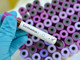 Coronavirus: nessun nuovo caso legato al cluster di Savona, dimessi due ricoverati