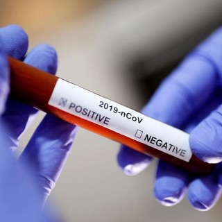 Coronavirus, il bollettino quotidiano sarà consultabile sul sito della Regione