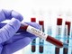 Coronavirus: la provincia di Savona è "fanalino di coda" in Liguria per numero di contagiati Coronavirus: la provincia di Savona è "fanalino di coda" in Liguria per numero di contagiati