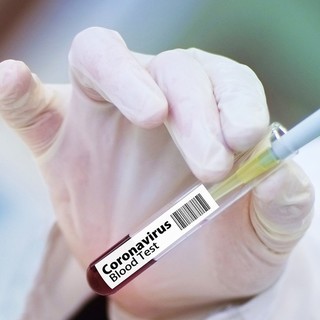 Pfizer annuncia: "Il nostro vaccino contro il Covid efficace al 90%, prime dosi entro l'anno"