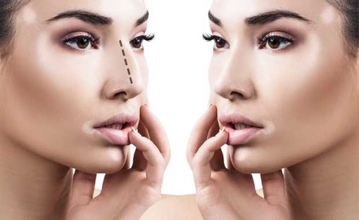 Chirurgia plastica: tutto quello che c'è da sapere