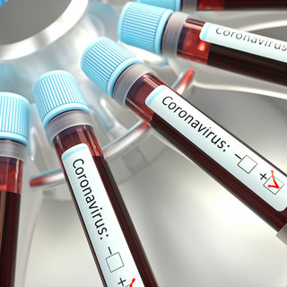 Covid: numeri ancora in calo quest'oggi, scende il rapporto tamponi-positivi