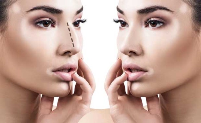 Chirurgia plastica: tutto quello che c'è da sapere