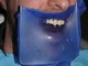 Diga per denti: aiutatemi a capire se è davvero così Diga per denti: aiutatemi a capire se è davvero così