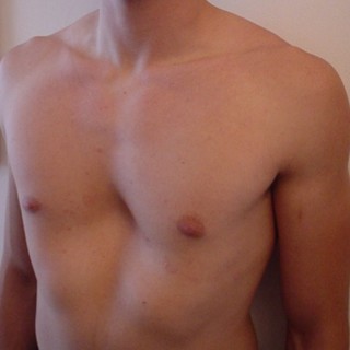 PectuSmile: le persone non sono perfette....tranne quando sorridono