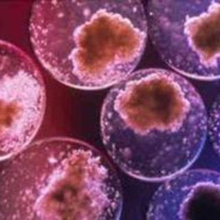 Malattie rare, tre centri di riferimento a Genova