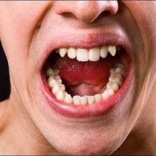 Bandito in negozio, commerciante lo morde