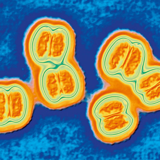 Liguria: è di nuovo allarme meningite?