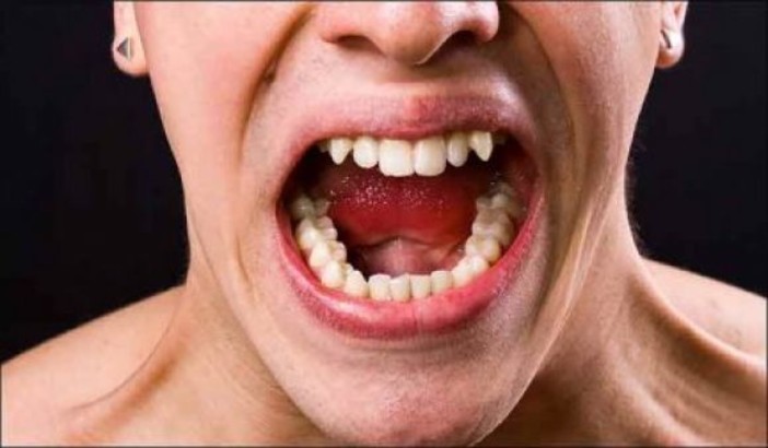 Bandito in negozio, commerciante lo morde