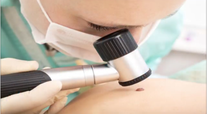 Controllo dei nei prima dell’estate, speciale promozione di Omnia Medica nel mese di maggio