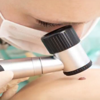 Controllo dei nei prima dell’estate, speciale promozione di Omnia Medica nel mese di maggio Controllo dei nei prima dell’estate, speciale promozione di Omnia Medica nel mese di maggio