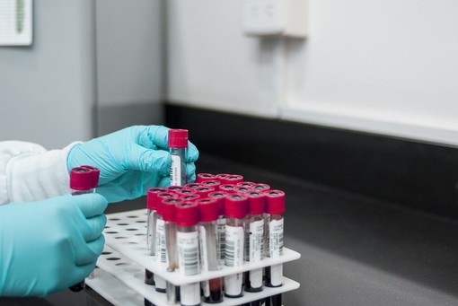 Coronavirus: in Liguria 186 nuovi positivi su 1.570 tamponi effettuati
