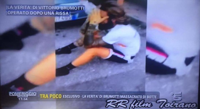 Vittorio Brumotti aggredito a Toirano: la sua verità a "Pomeriggio 5"