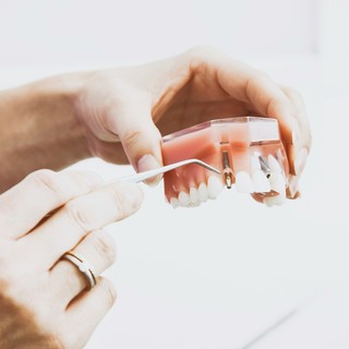 Protesi dentarie: una soluzione per ritrovare il sorriso e la funzionalità