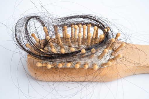 Cosa fare e cosa non fare dopo un trapianto di capelli Cosa fare e cosa non fare dopo un trapianto di capelli