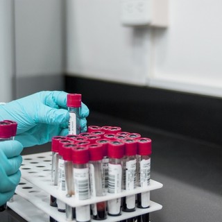 Coronavirus, in Liguria 761 nuovi positivi su 6.476 tamponi