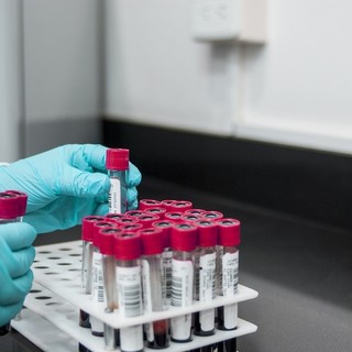 Coronavirus: in Liguria 945 nuovi positivi nelle ultime 24 ore