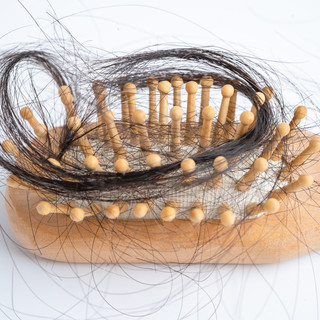Cosa fare e cosa non fare dopo un trapianto di capelli