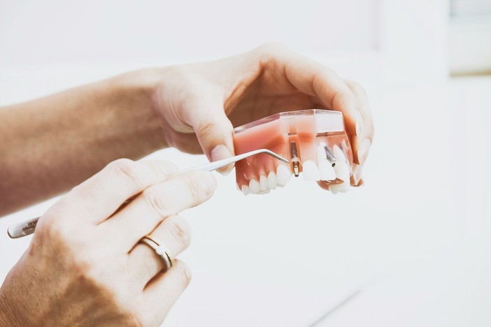 Protesi dentarie: una soluzione per ritrovare il sorriso e la funzionalità