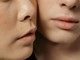 Dire addio alle cicatrici da acne: scopri i trattamenti non farmacologici a Cuneo