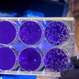 Forse una buona notizia dalla Francia nella lotta al Coronavirus