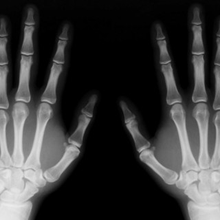 Firma radiografie per creare falso alibi, arrestato medico