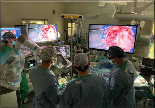 Un nuovo Esoscopio 3D 4K per la Neurochirurgia del Santa Corona (FOTO e VIDEO) Un nuovo Esoscopio 3D 4K per la Neurochirurgia del Santa Corona (FOTO e VIDEO)