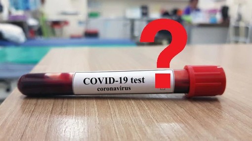 Test sierologici Covid-19 ai donatori di sangue: i chiarimenti dell'AVIS