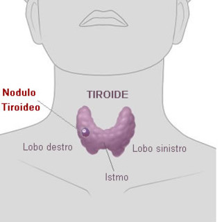 Torna la "Settimana della Tiroide" Torna la "Settimana della Tiroide"