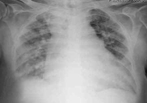 Inquinamento e mortalità, il Dott. Ireo Bono a Savonanews: "colpisce il silenzio degli oncologi" Inquinamento e mortalità, il Dott. Ireo Bono a Savonanews: "colpisce il silenzio degli oncologi"