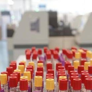 Cos'è il batterio mangiacarne trovato nello Stretto di Messina, minaccia in crescita per il caldo record