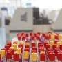 Cos'è il batterio mangiacarne trovato nello Stretto di Messina, minaccia in crescita per il caldo record