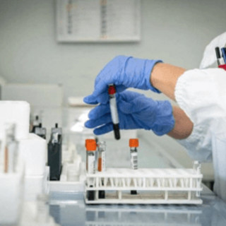 Alzheimer, test del sangue possono prevedere l'inizio dei sintomi