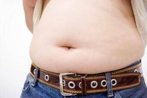 Obesità, allarme ictus anche nei giovani: peso in eccesso moltiplica il rischio Obesità, allarme ictus anche nei giovani: peso in eccesso moltiplica il rischio